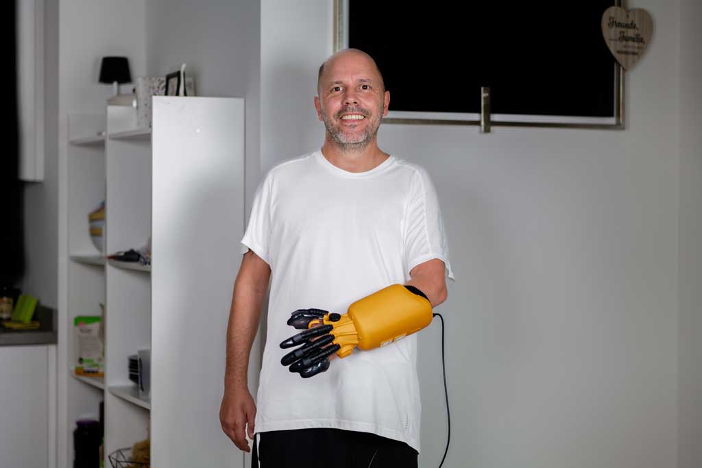 exomotion hand one Anwender Kay