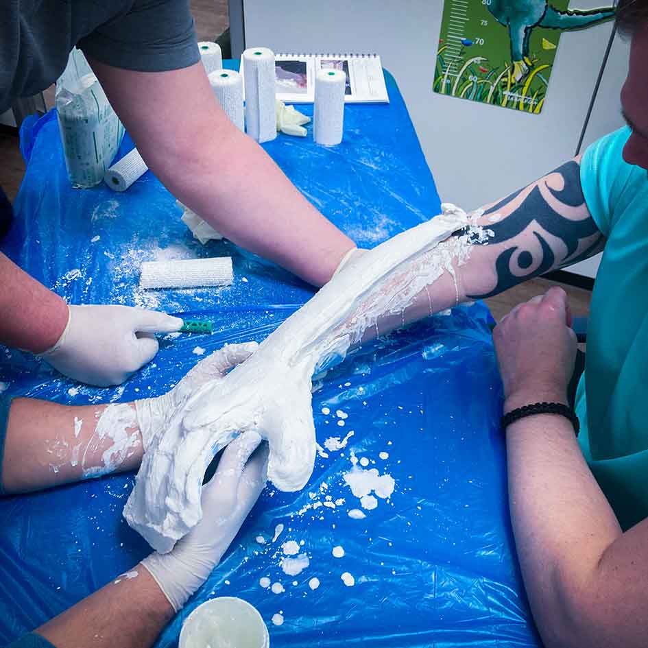 Gipsen_Hand_und_Arm_für_exomotion-hand-one